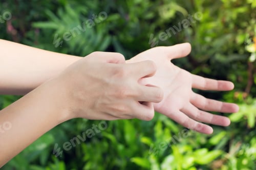 Preview: Man scratch the itch with hand, Arm, Itching, Concept with Healthcare And Medicine.