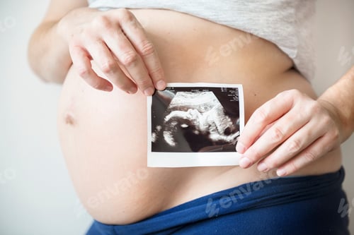 Preview: Pregnant woman showing fetus ultrasound photo