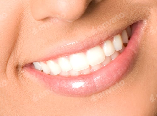 Preview: Healthy woman teeth and smile close up