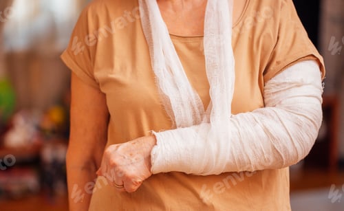 Preview: An elderly woman with a cast on her arm in the living room. A mature lady with a bandaged arm