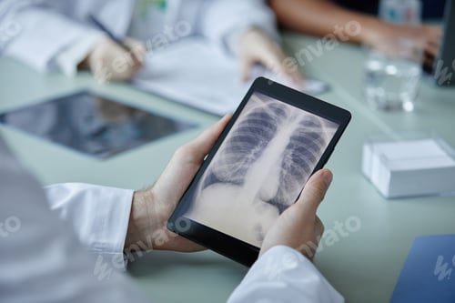 Preview: Close Up of Unrecognizable Doctor Holding Digital Tablet with X Ray Image