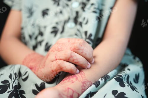 Preview: little girl suffering from itching skin on her hand