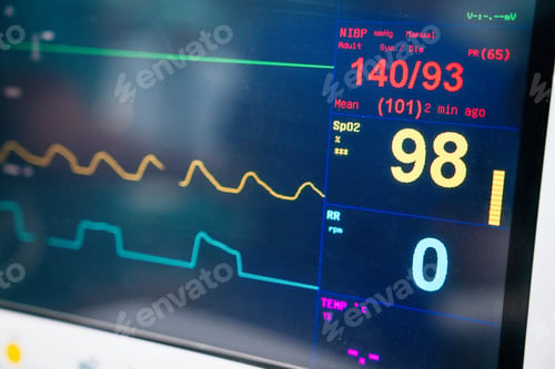 Preview: Ekg machine in hospital emergency room used for heart attack diagnosis