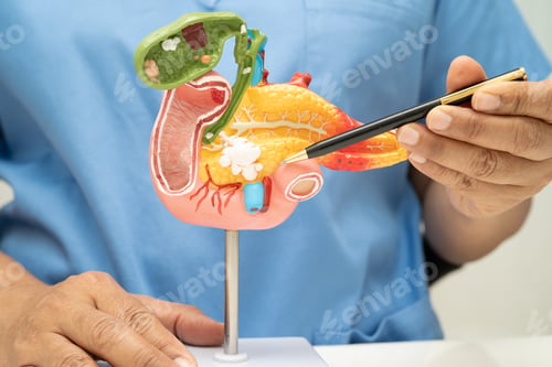 Preview: Pancreatitis, pancreatic cancer, Asian doctor with pancreas, gallbladder
