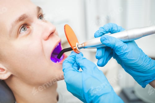 Preview: Dentist's office, dental treatment tools, drill bit, closeup, indoor. patient