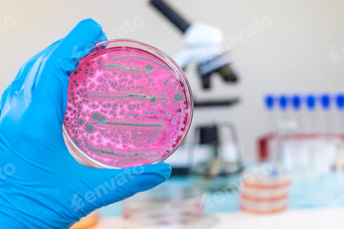 Preview: Examine bacteria in petri dishes in the laboratory. Selective focus.