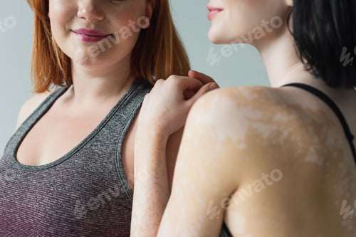 Preview: Cropped view of sportswoman with vitiligo hugging plus size friend isolated on grey