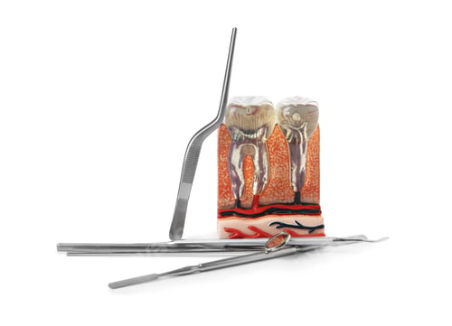 Preview: Educational model of jaw section with teeth and professional tools on white background