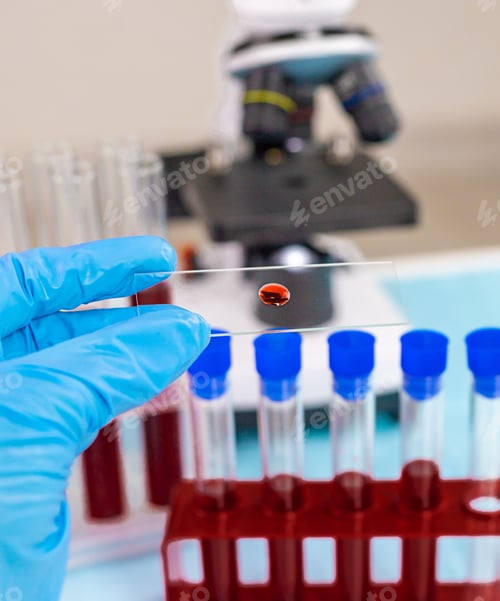 Preview: examine blood in the laboratory. Selective focus.