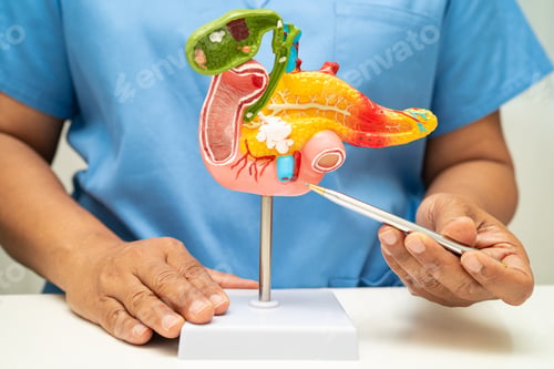 Preview: Pancreatitis, pancreatic cancer, Asian doctor with pancreas, gallbladder and bile duct