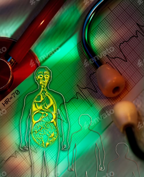 Preview: Medical - Cardiology