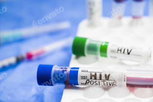 Preview: Selective focus of positive HIV blood specimen on test tube in the laboratory