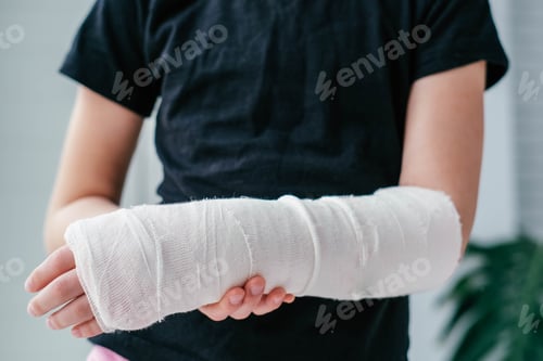 Preview: Close-up of a broken arm of a child in a cast. The girl holds her hand bent