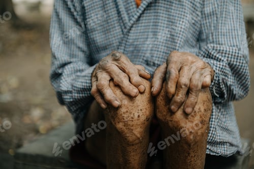 Preview: Close up of male wrinkled hands, old man is wearing skin disease and anxiety Copy space.