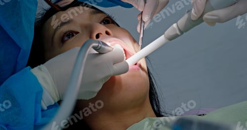 Preview: Woman have dental care in the clinic