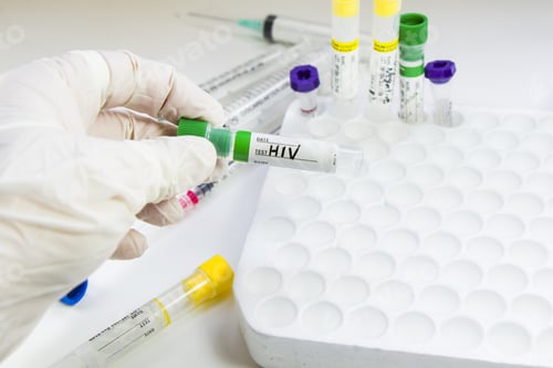 Preview: Closeup shot of an empty blood test sample tube in doctors hand with white gloves
