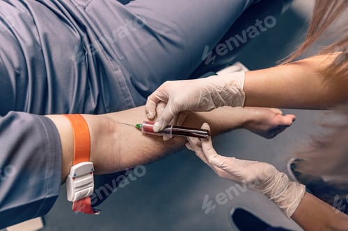 Preview: Venipuncture or venepuncture procedure