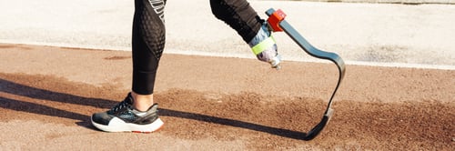 Preview: Young sportswoman with prosthesis walking on city bridge