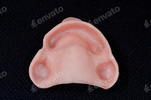Preview: oral rehabilitation process, partial removable prosthesis