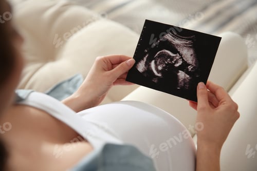 Preview: Pregnant woman holding ultrasound picture near her belly indoors, closeup
