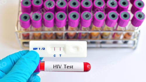 Preview: HIV virus, medical concept, Human Immunodeficiency Virus Positive test