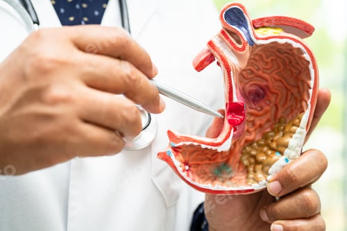 Preview: Stomach disease, doctor holding anatomy model for study diagnosis and treatment in hospital.