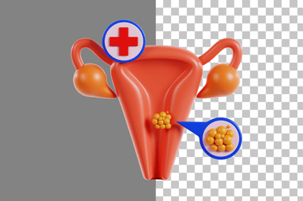 Preview: Cervical Cancer 3D Icon