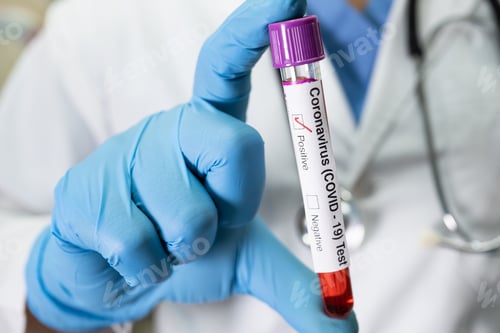 Preview: Positive blood infection sample in test tube for covid-19 coronavirus in lab. Scientist holding