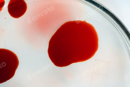 Preview: Close up of blood test tube with blood