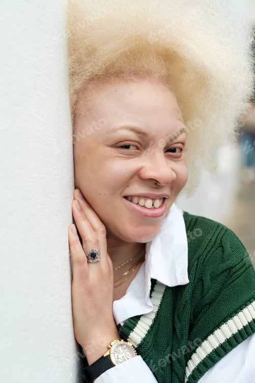 Preview: Fun portrait of albino woman smiling at camera.