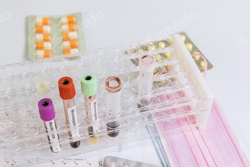 Preview: Medical supplies on a test tube blood the stethoscope and pills Monkeypox smallpox infections
