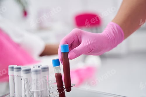 Preview: Blood placed in a tube is placed in special holder