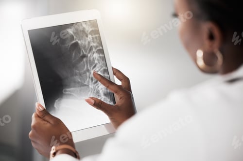 Preview: Shot of a doctor analysing an x ray on the screen of a digital tablet