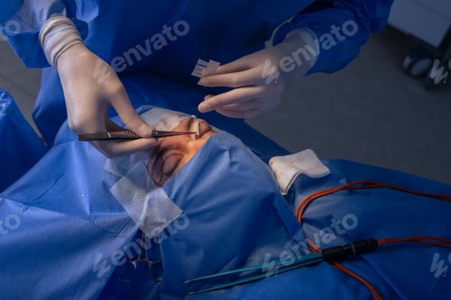 Preview: close-up eyes after eye surgery , blepharoplasty operation, plastic surgeon