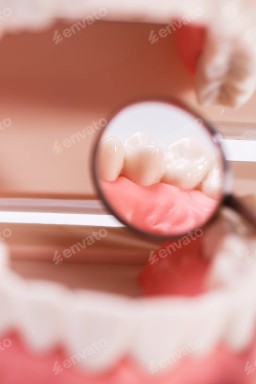 Preview: White teeth