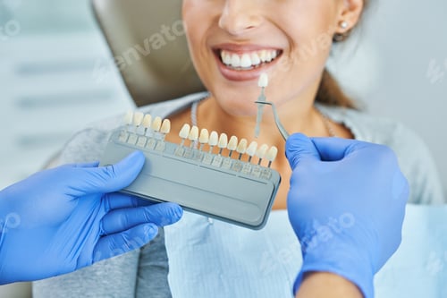 Preview: Male dentist and woman choosing tooth shade in dentist office