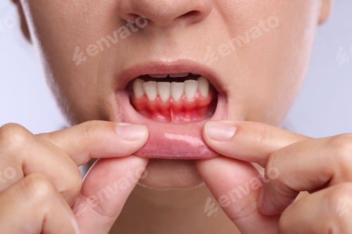 Preview: Woman showing inflamed gum on light background, closeup