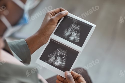 Preview: Ultrasound image in woman's hand
