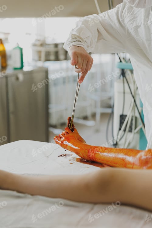 Preview: Doctor using medical tools treating injured foot