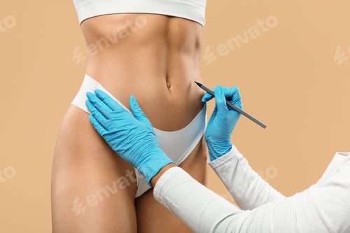 Preview: Doctor drawing marks on female stomach, preparing for cosmetic surgery operation