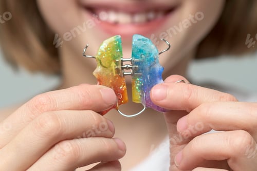Preview: Smiling child shows colorful orthodontic retainer in hands during dental visit