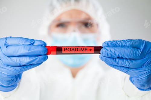 Preview: Medical technologist holding blood sample test tube POSITIVE
