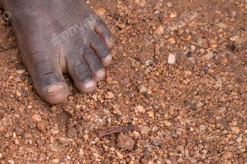 Preview: Poverty Child Feet in Africa