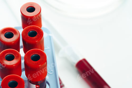 Preview: Close up of blood test tube with blood