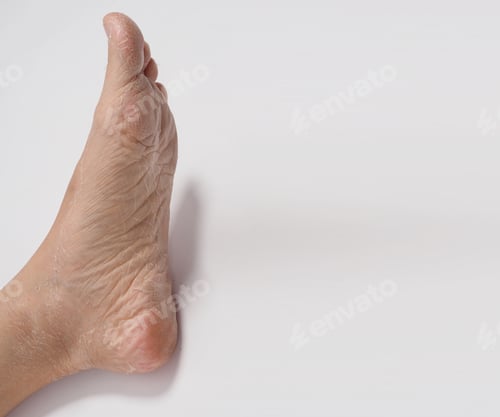 Preview: Foot peeling or remove dead skin on white background.