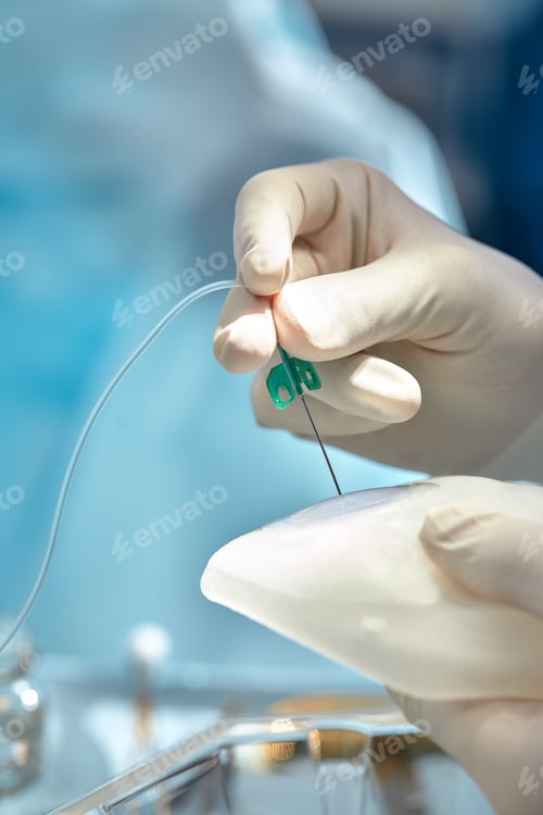 Preview: A surgeon with an assistant operates on the female breast, mammoplasty, breast oncology.