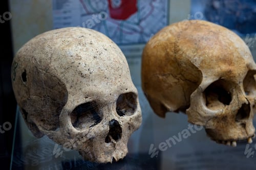 Preview: An exhibit of a human skull. Real human skull.