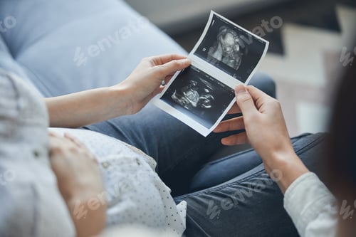 Preview: First picture of the baby after ultrasound scanning