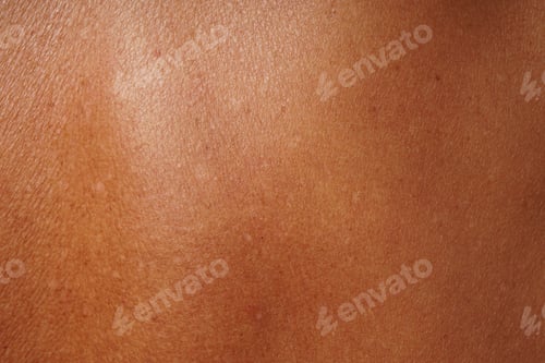Preview: close-up human skin damaged by age and sun tanning