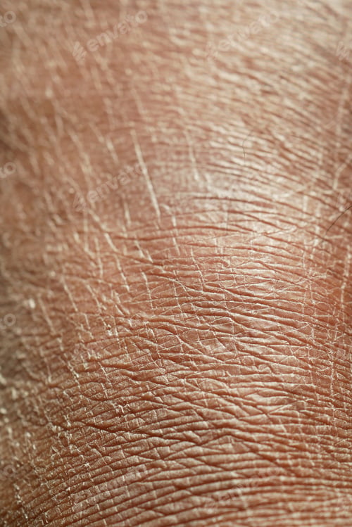 Preview: Closeup view of dry human skin .